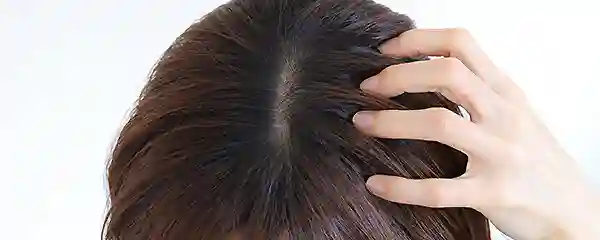ヘナにかぶれたことがある