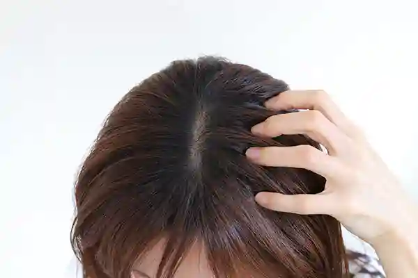 ヘナにかぶれたことがある